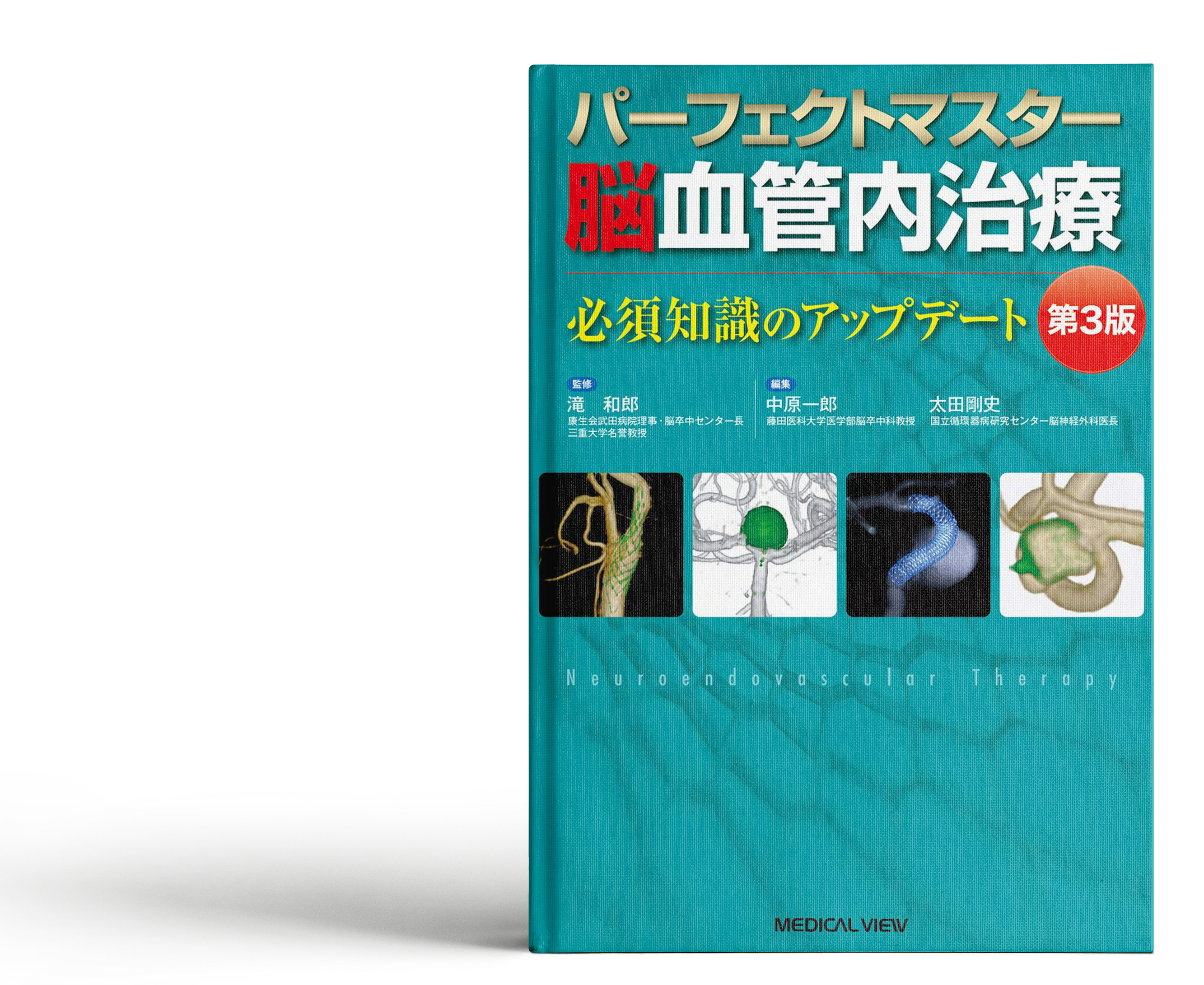 パーフェクトマスター脳血管内治療 第3版が刊行されました - 藤田医科 