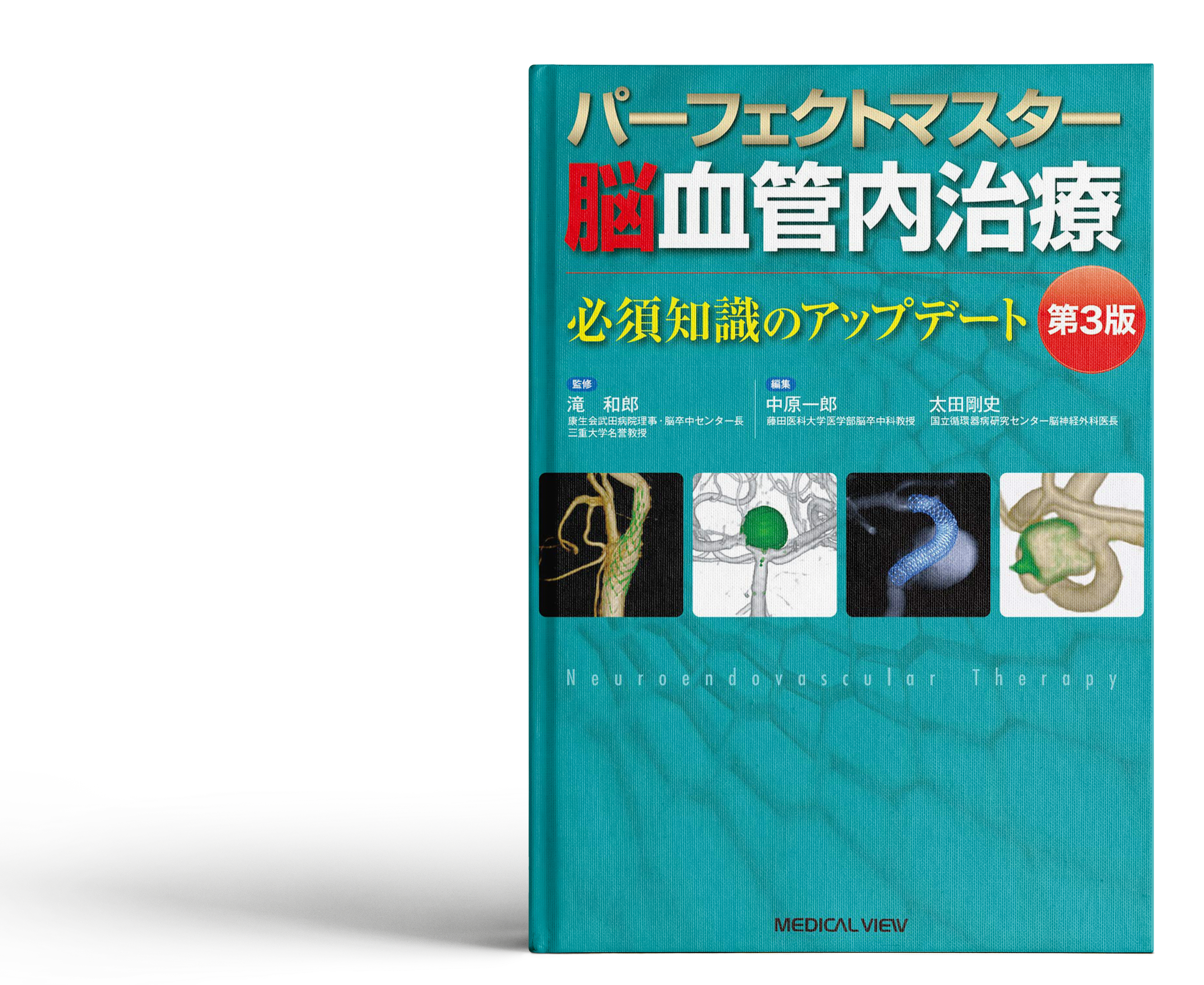 パーフェクトマスター脳血管内治療 第3版が刊行されました - 藤田医科